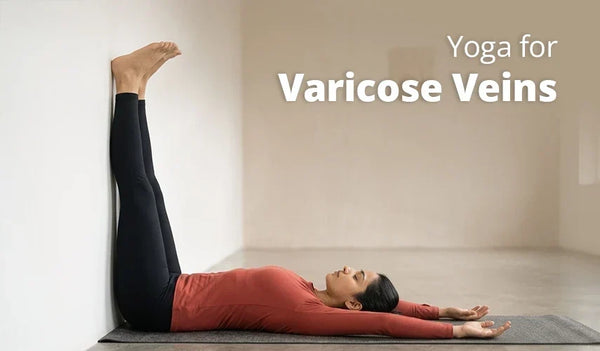 Yoga for Varicose Veins